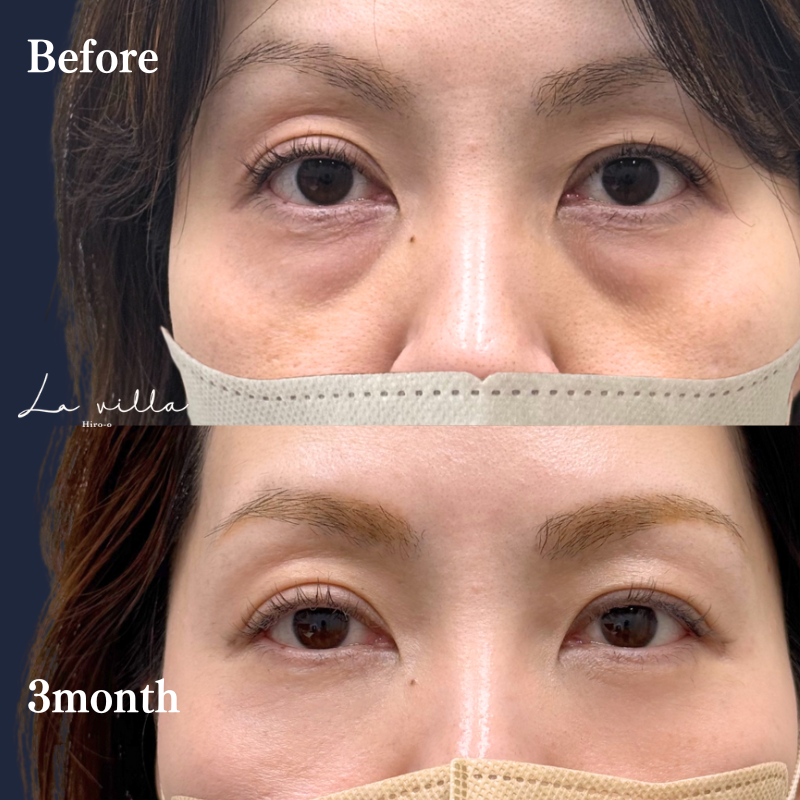 裏ハムラ　No.297