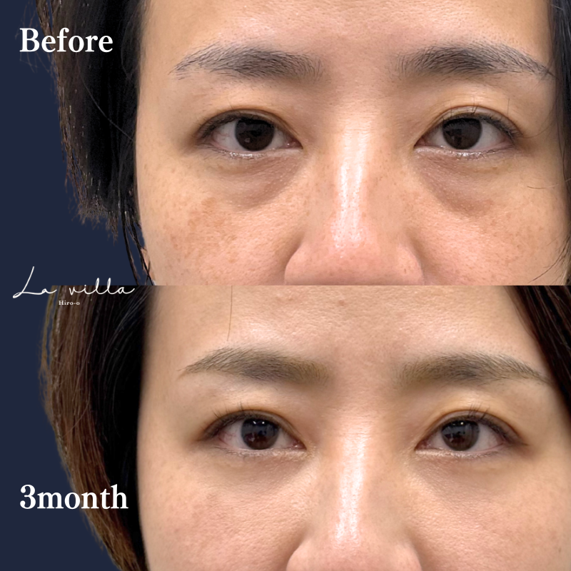 裏ハムラ　No.306