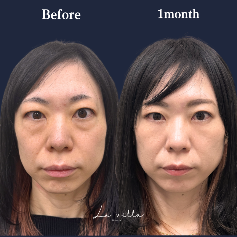 裏ハムラ　No.318