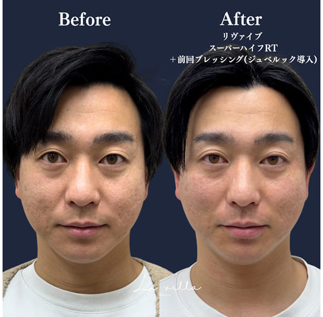 CASE 01 Before / After