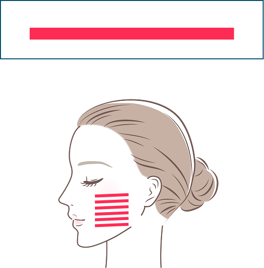 一方向リニア照射