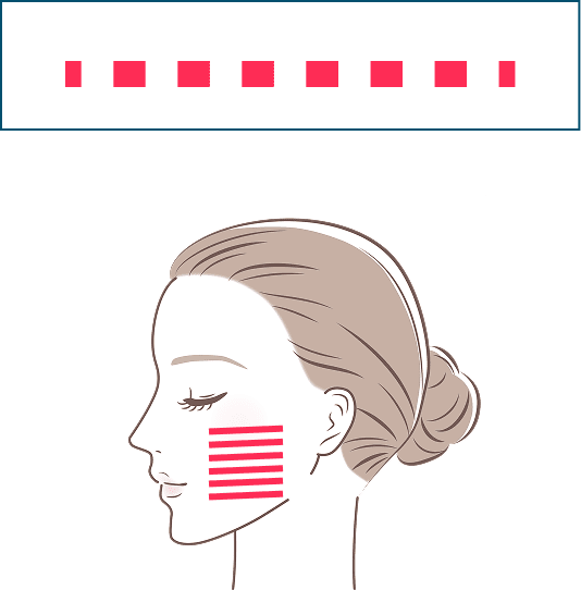 一方向リニア照射