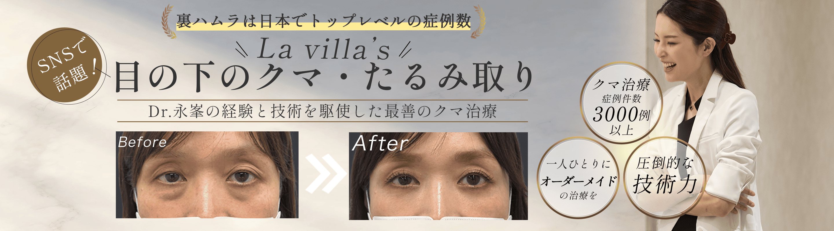 目の下のたるみ取り｜ 東京で目の下のクマ取りをうけるなら