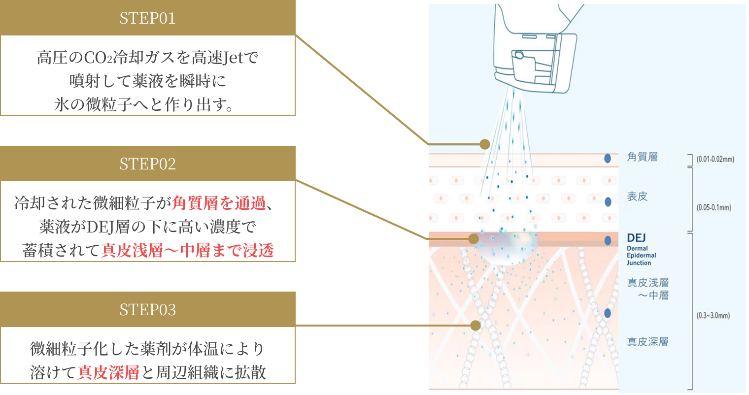 アイス・ニードリング 浸透イメージ