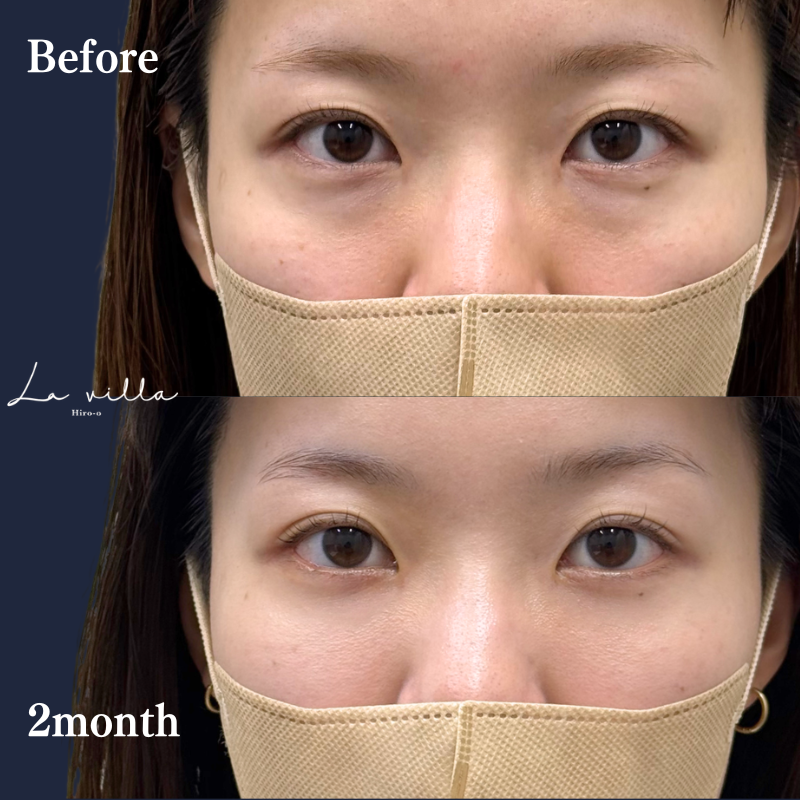 裏ハムラ　No.345