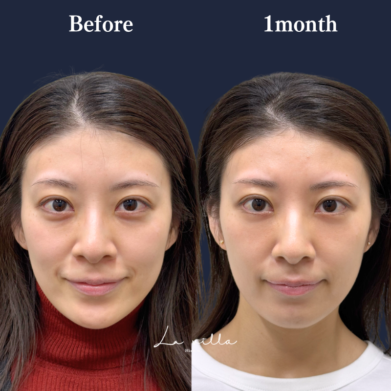 裏ハムラ　No.346