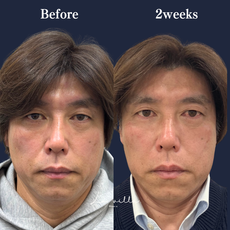 ブナジュ  No.348