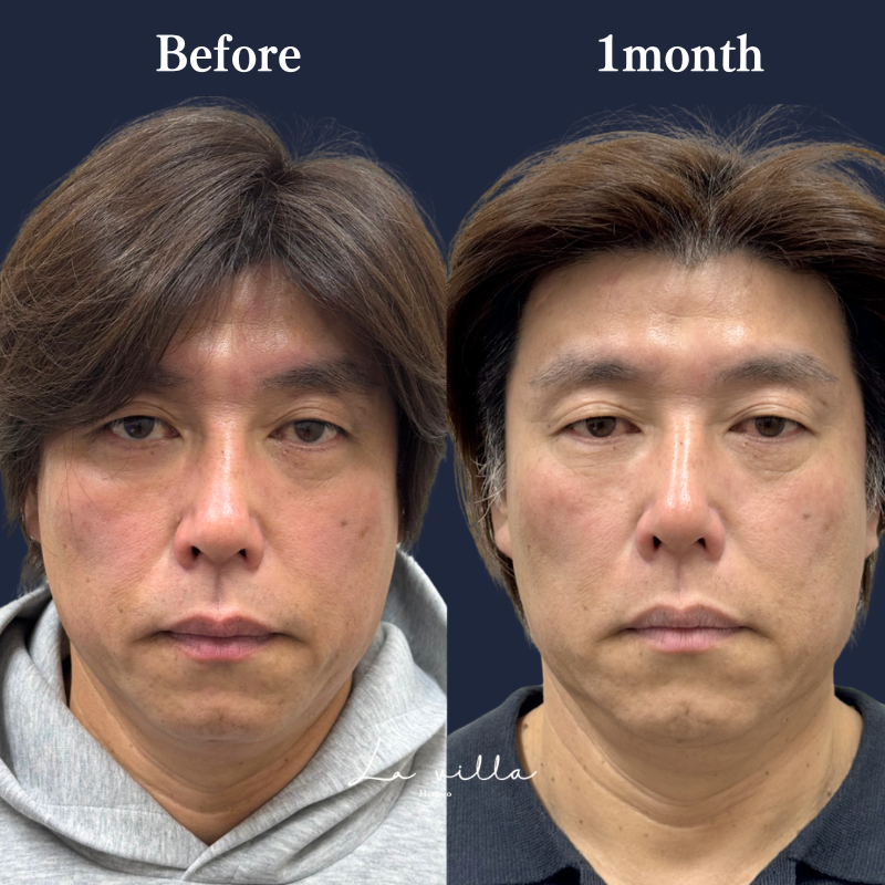 ブナジュ  No.350