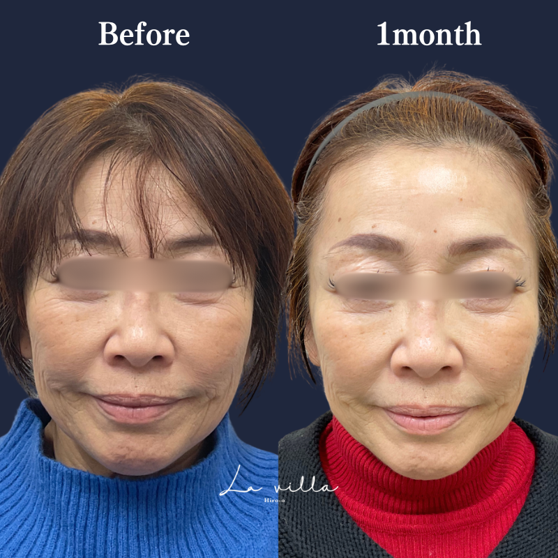 ブナジュ  No.349