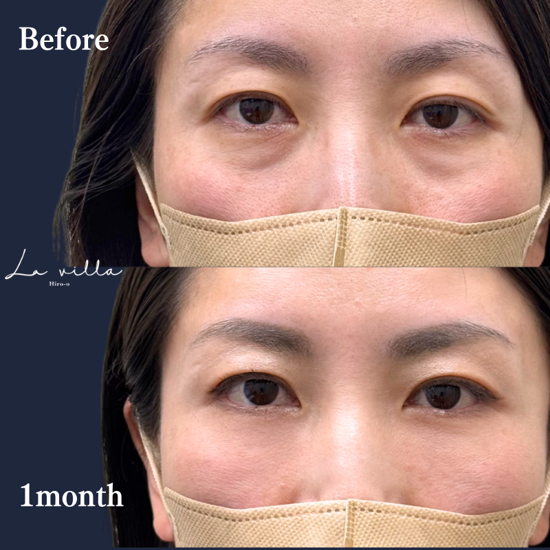 裏ハムラ　No.354