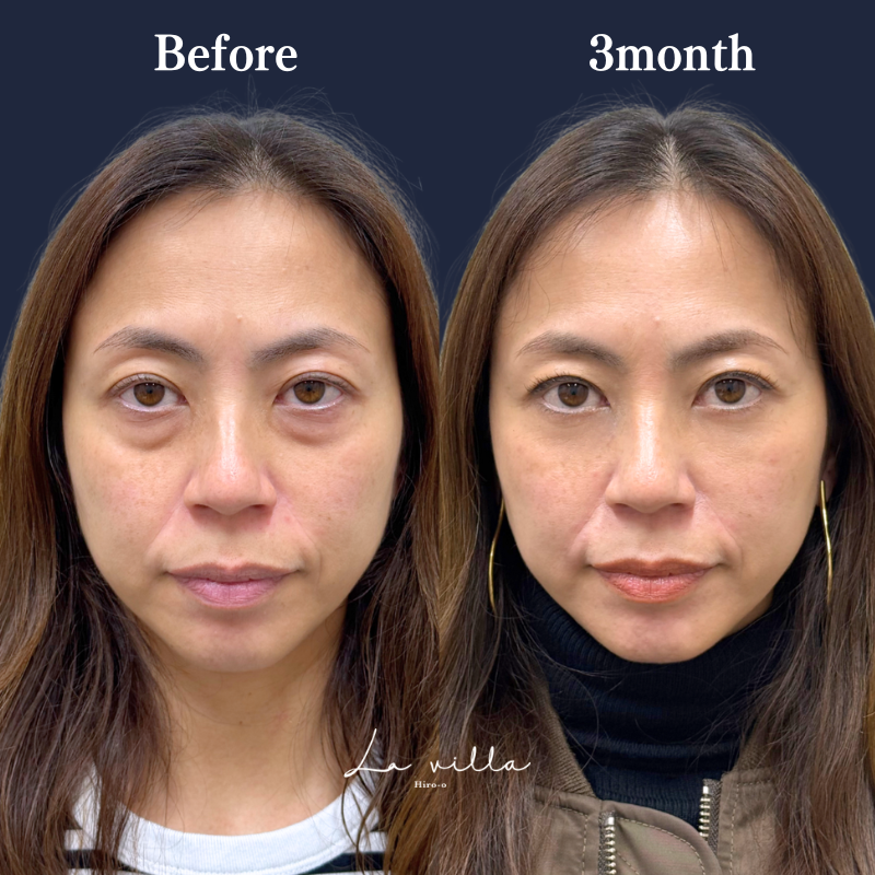 裏ハムラ　No.356