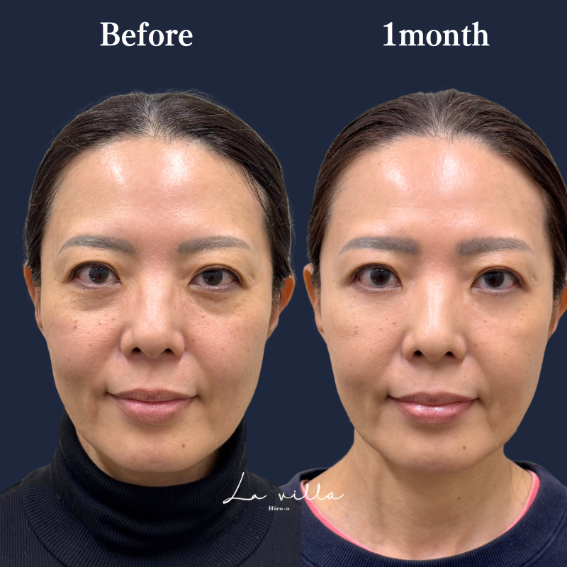 裏ハムラ　No.357