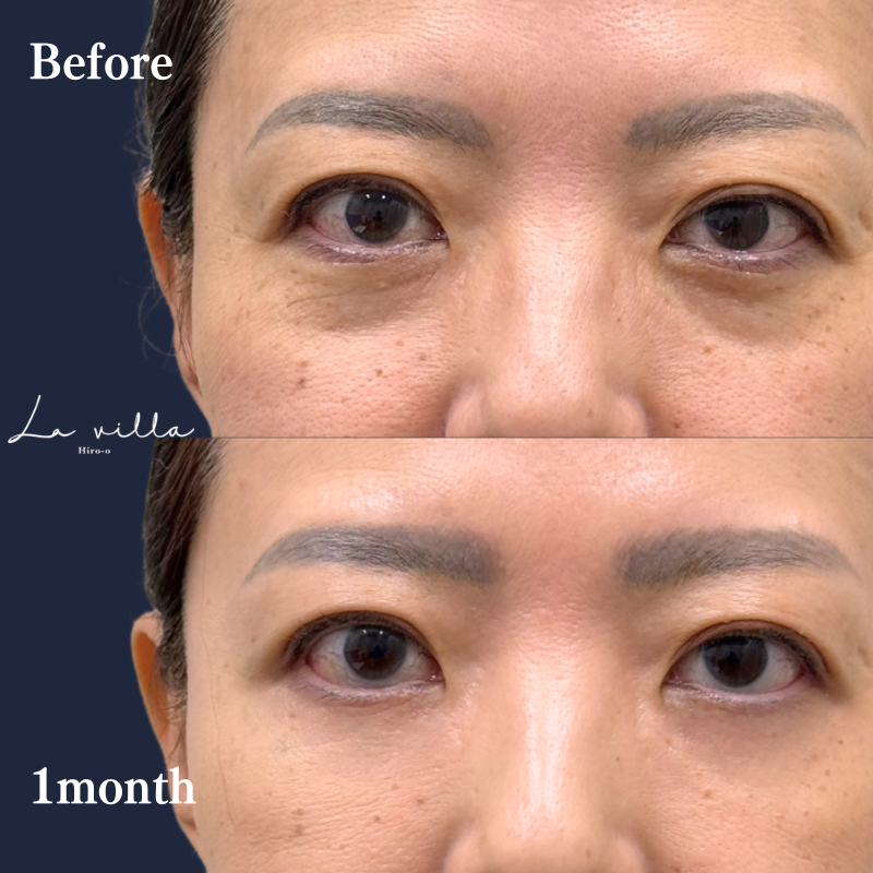 裏ハムラ　No.357