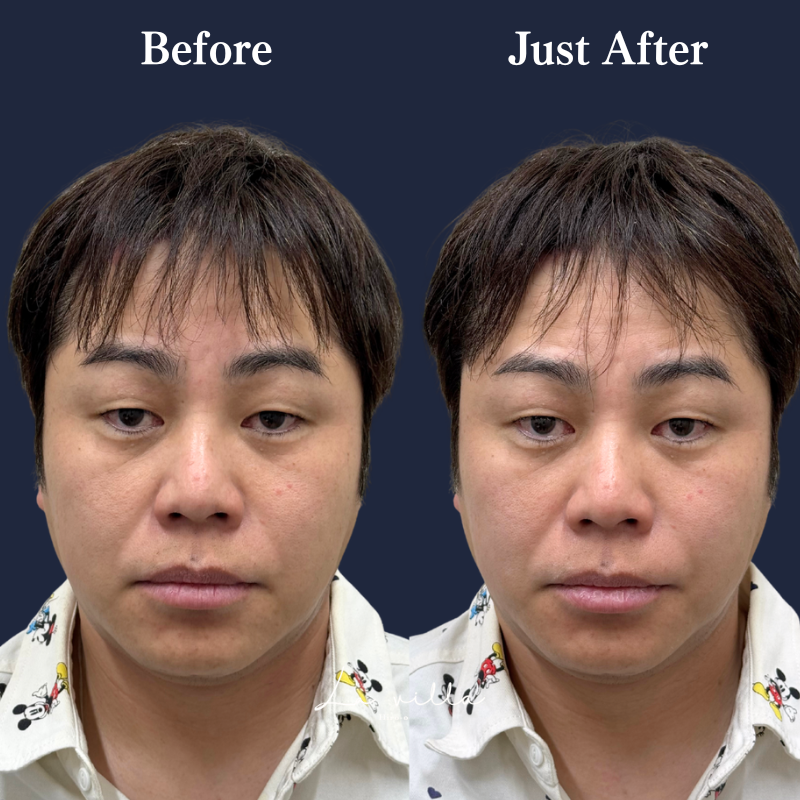 スーパーハイフRT No.359