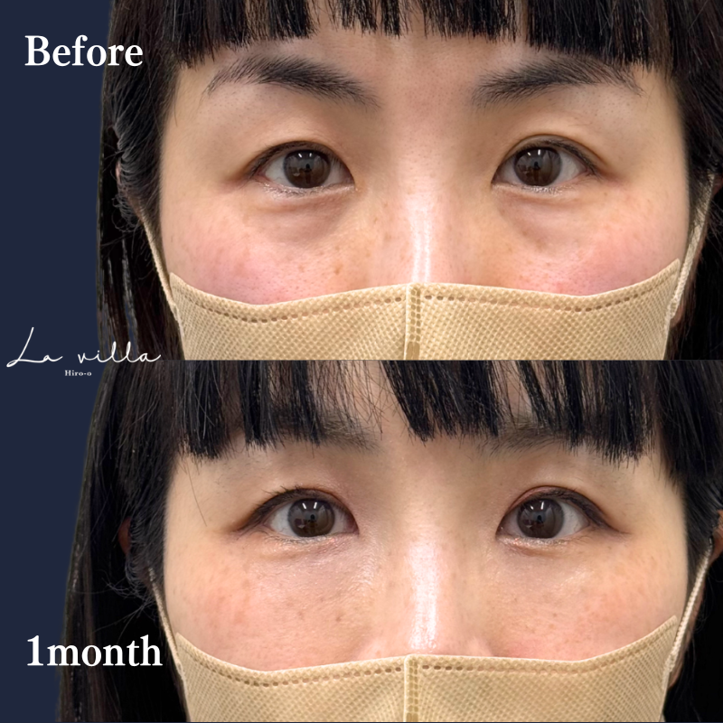 裏ハムラ　No.333