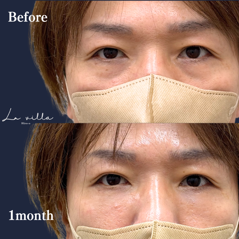 裏ハムラ　No.334