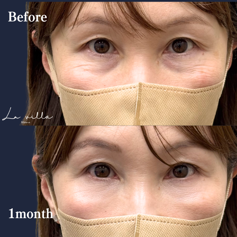 裏ハムラ　No.336