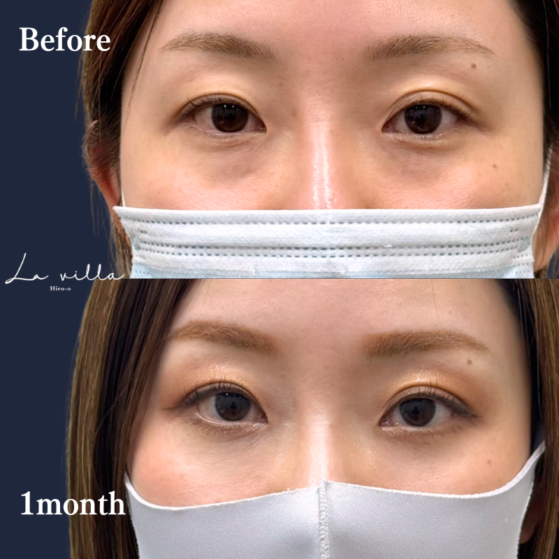 裏ハムラ　No.337