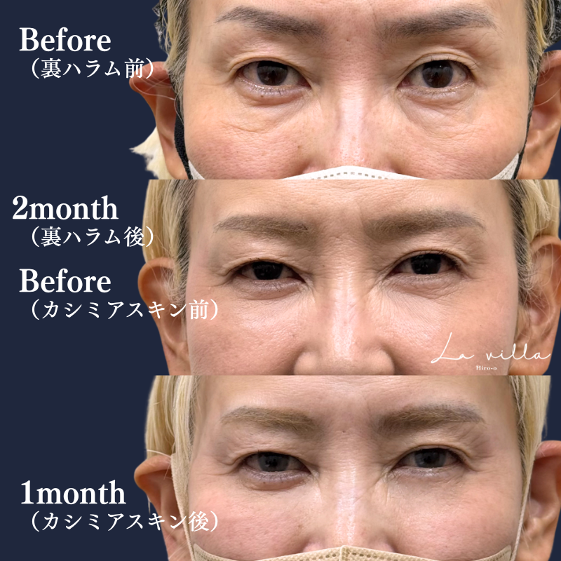 カシミヤスキン＋裏ハラム No.374