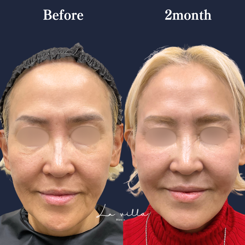 カシミヤスキン＋裏ハラム No.375