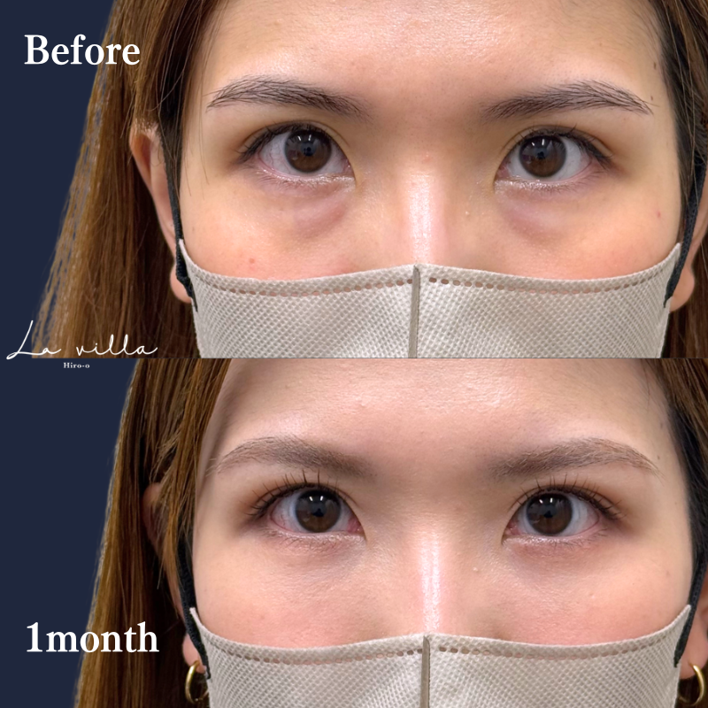 裏ハムラ　No.380