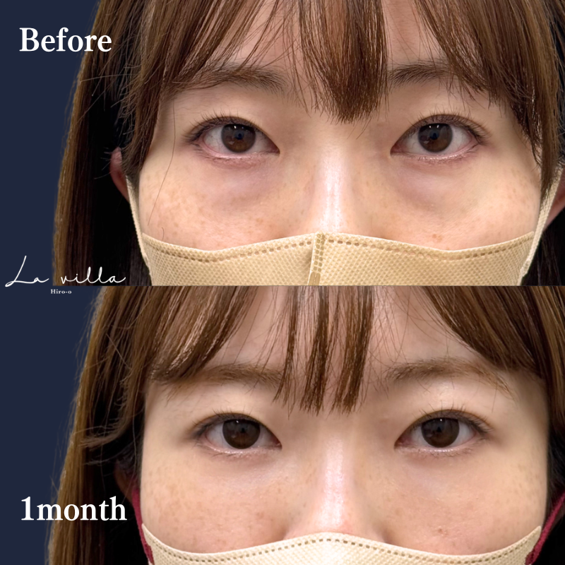 裏ハムラ　No.381