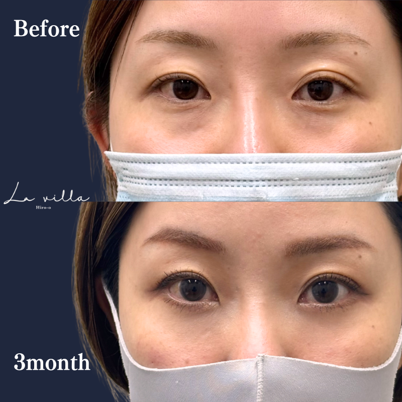 裏ハムラ　No.388