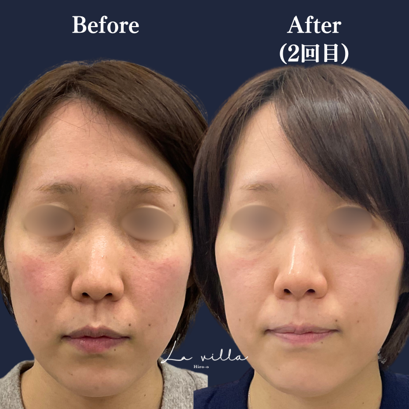 カシミアスキン No.390