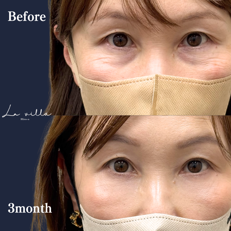 裏ハムラ　No.393