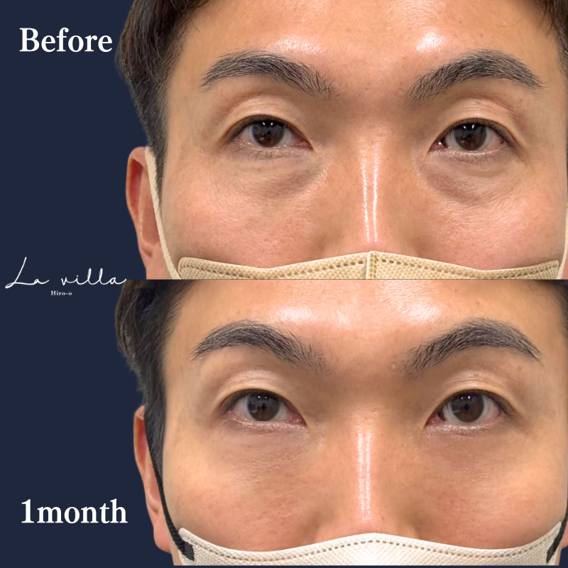 裏ハムラ　No.394