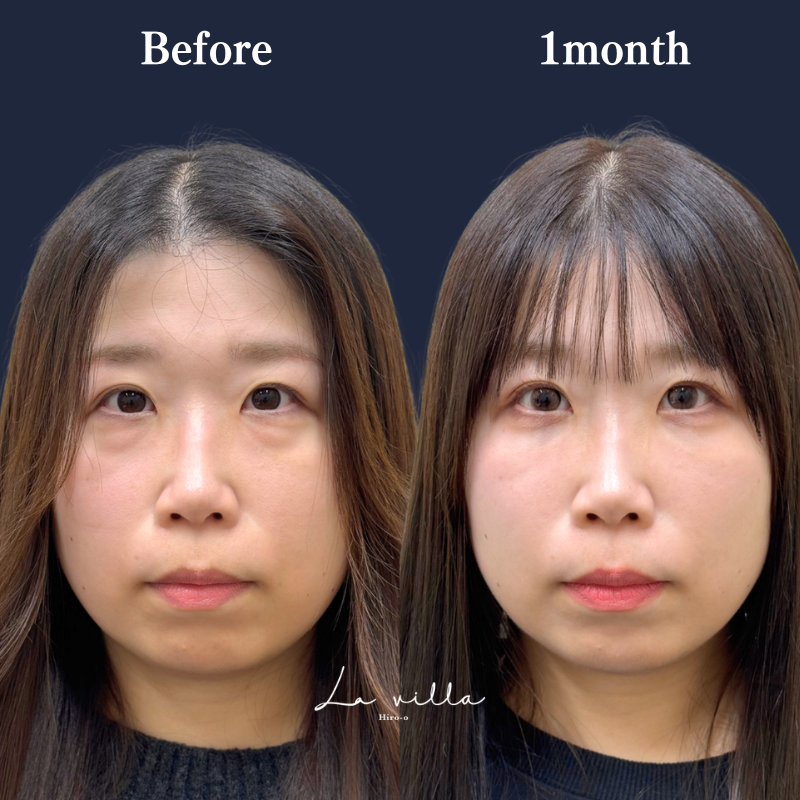 裏ハムラ　No.403