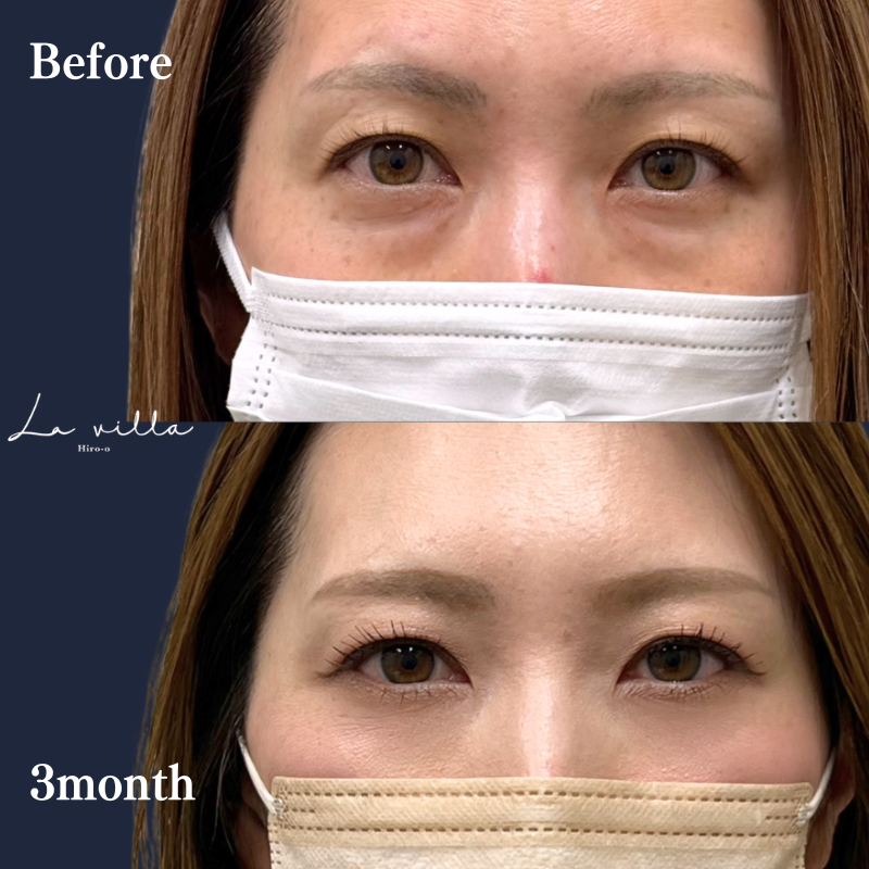 裏ハムラ　No.404