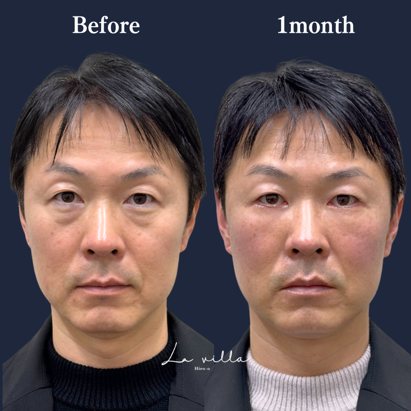 表ハムラ　No.405