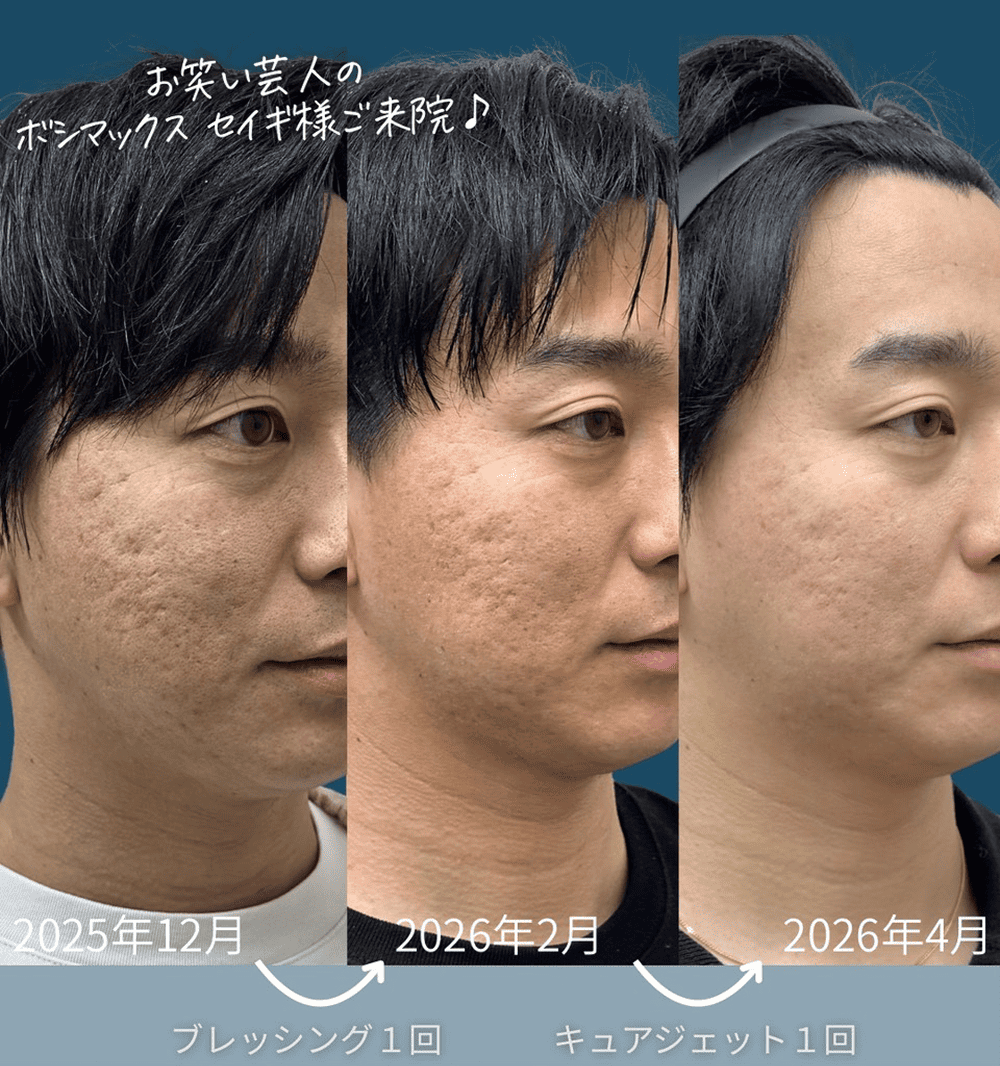 ボシマックス せいぎさん 症例