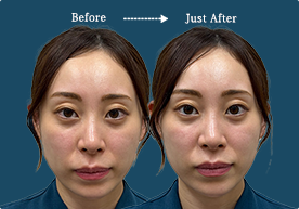 CASE 01 Before / After