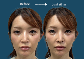 CASE 02 Before / After