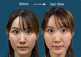 CASE 03 Before / After
