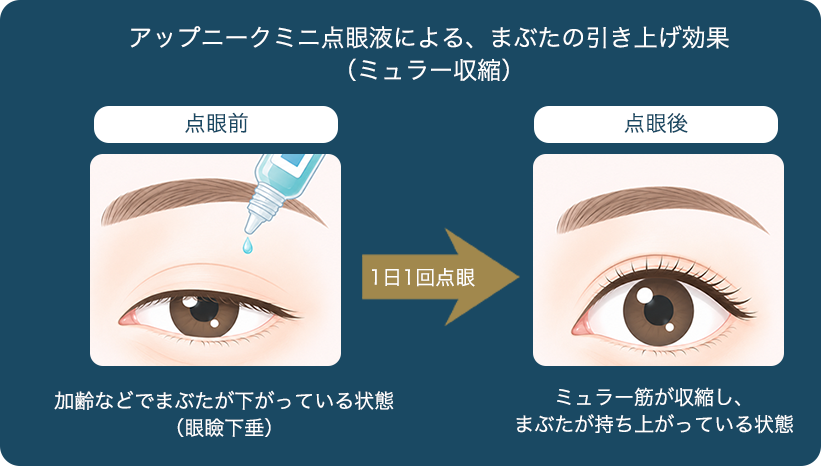 アップニークミニの点眼前後の比較