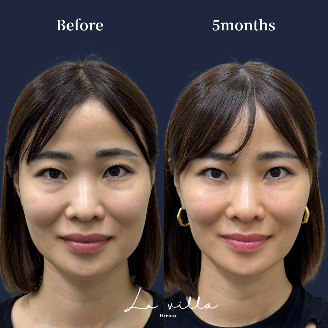 裏ハムラ No.657