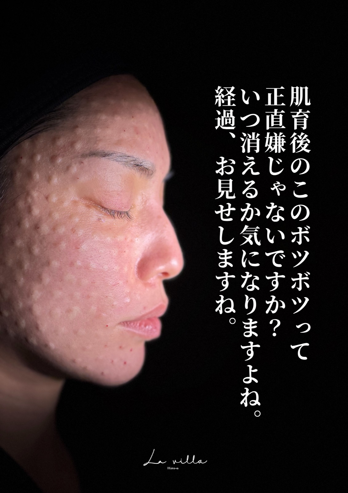 ダウンタイムの経過
