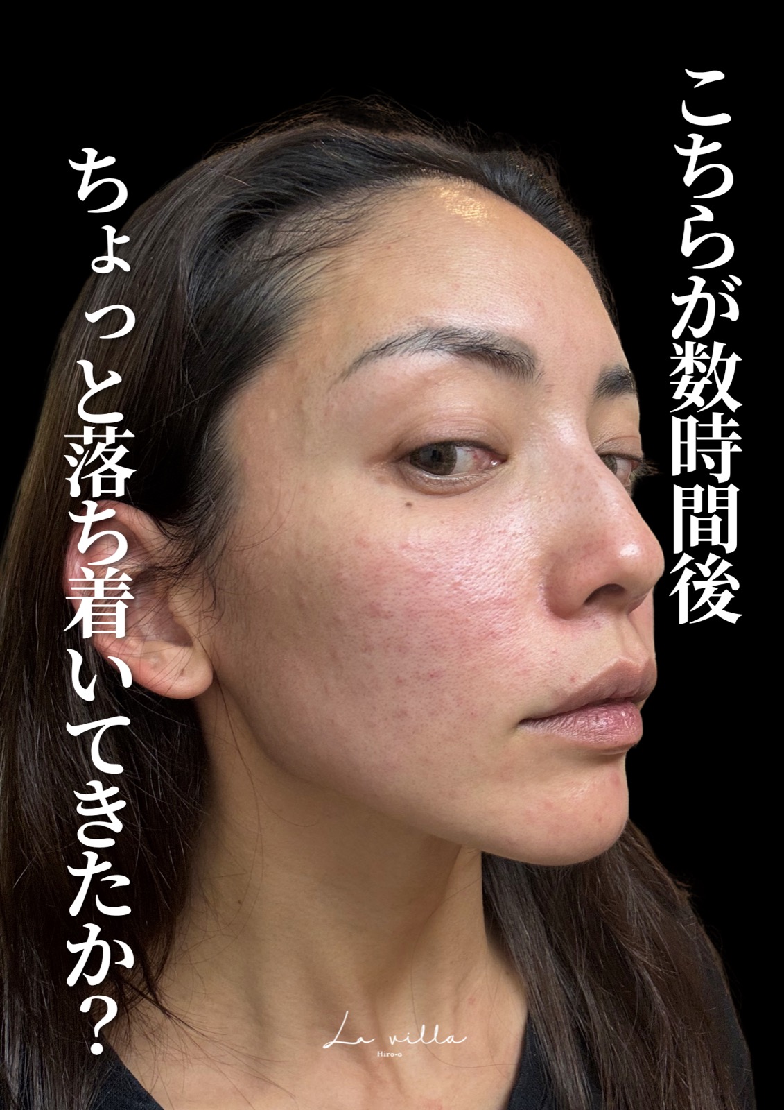 ダウンタイムの経過