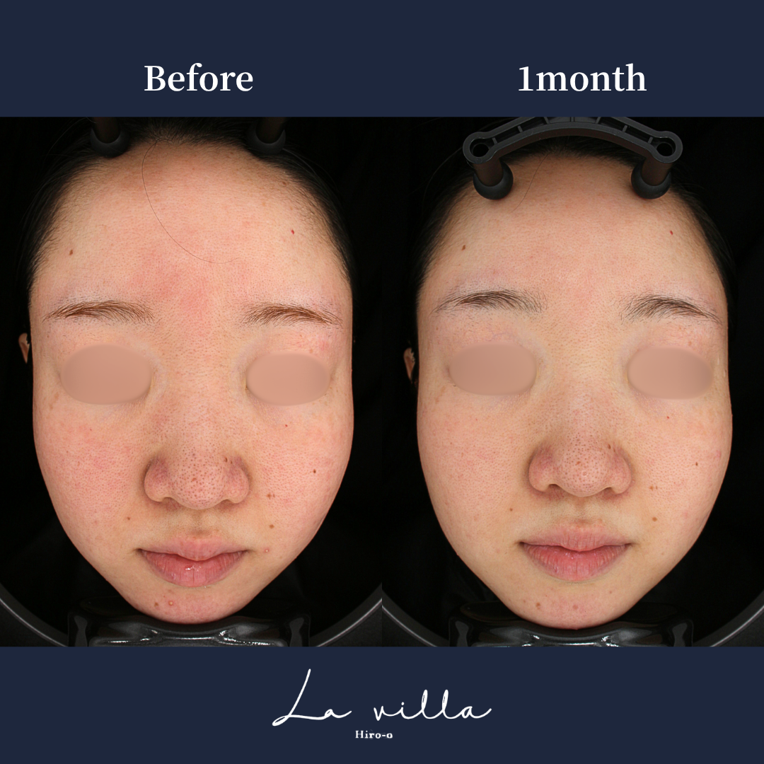 ステラM22 No.666