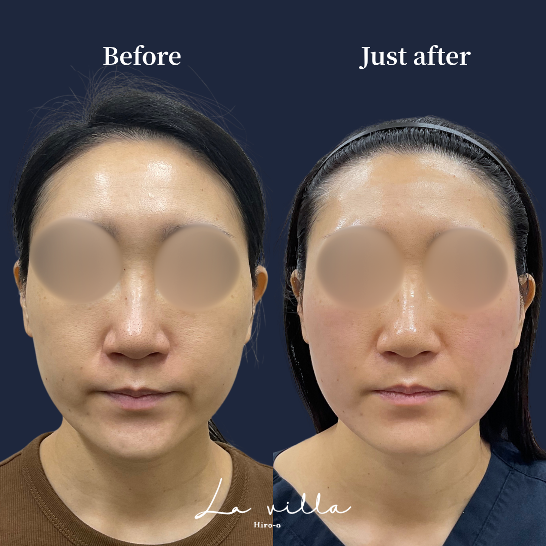ピアモノビリティ No.724